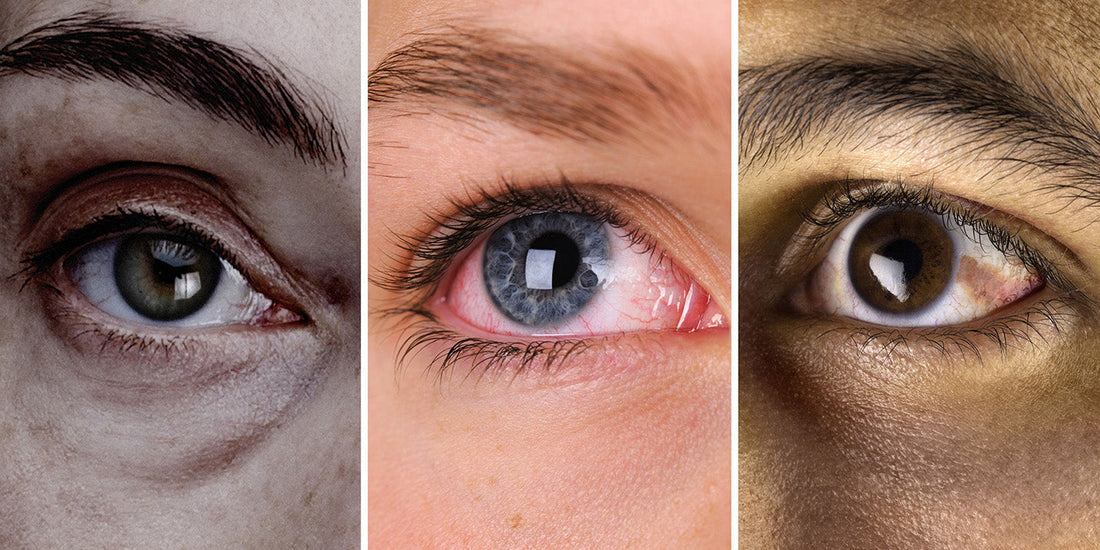 How to Improve Eye Health by Brian Ang – Tips & Advice
